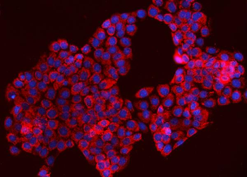 Anti-TOMM70 Antibody