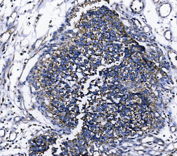 Anti-TOMM70 Antibody