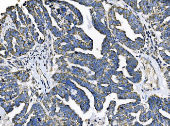 Anti-TOMM70 Antibody