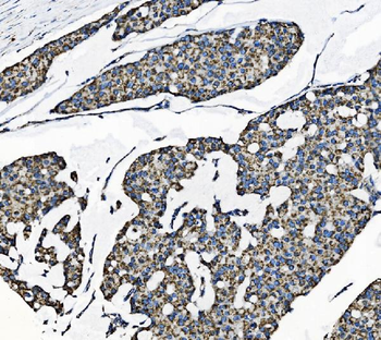 Anti-TOMM70 Antibody