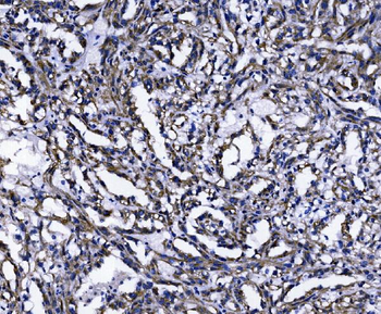 Anti-TOMM70 Antibody