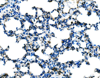 Anti-Tlr8 Antibody