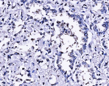 Anti-SUN2 Antibody