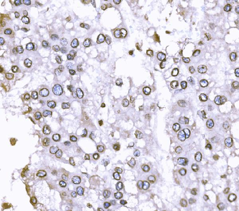 Anti-SUN2 Antibody
