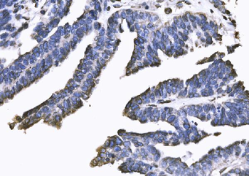 Anti-SUN2 Antibody