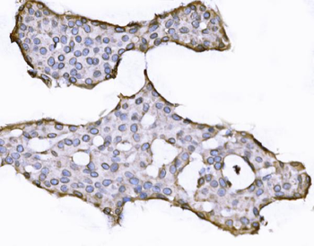 Anti-SUN2 Antibody