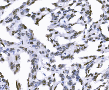 Anti-SUN2 Antibody
