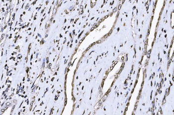 Anti-SUN2 Antibody