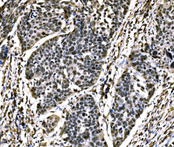 Anti-SnoN/SNO/SKIL Antibody