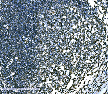 Anti-SnoN/SNO/SKIL Antibody