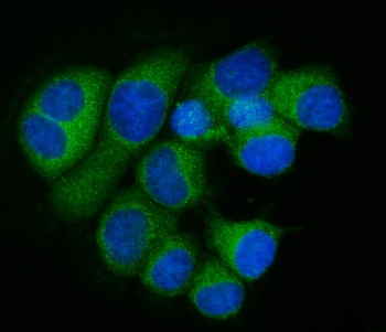 Anti-RPL32 Antibody