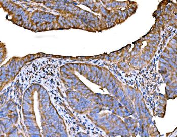 Anti-RPL32 Antibody