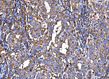 Anti-RPL32 Antibody