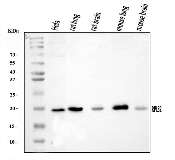 Anti-RPL32 Antibody