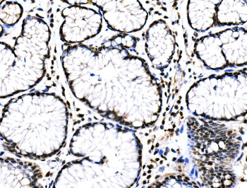 Anti-RAD18 Antibody
