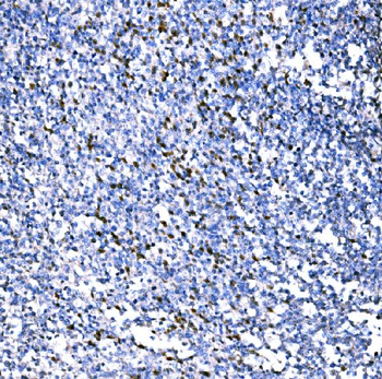 Anti-RAD18 Antibody