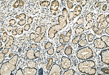 Anti-PPFIA1 Antibody