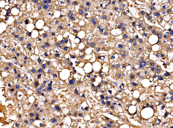 Anti-PPFIA1 Antibody