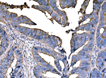 Anti-PPFIA1 Antibody