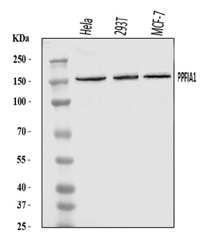 Anti-PPFIA1 Antibody