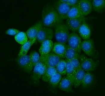 PPFIA1 Antibody