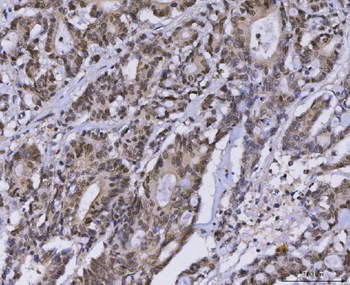 Anti-MLH1 Antibody