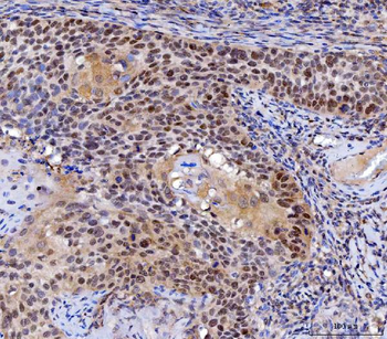 Anti-MLH1 Antibody