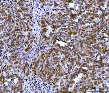 Anti-MLH1 Antibody