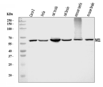 Anti-ME1 Antibody