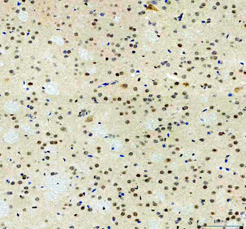 Anti-p38 alpha/MAPK14 Antibody