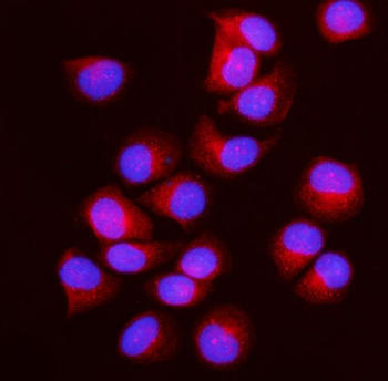 Anti-IFT43 Antibody