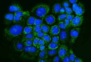 Anti-Glutaredoxin 1/GLRX Antibody