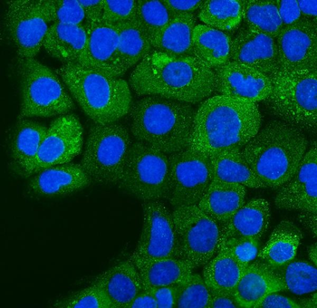 Anti-Ezrin/EZR Antibody