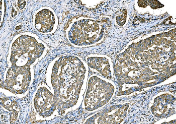 Anti-Ezrin/EZR Antibody