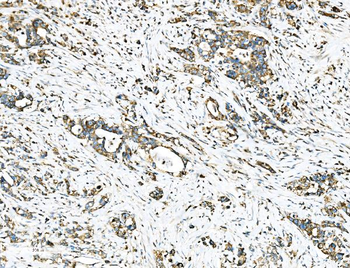 Anti-Ezrin/EZR Antibody
