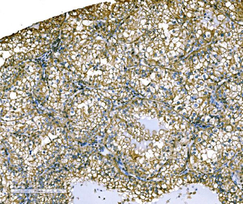 Anti-Ezrin/EZR Antibody