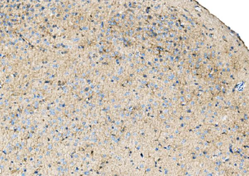 Anti-Ezrin/EZR Antibody