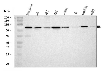 Anti-Ezrin/EZR Antibody