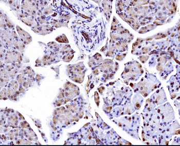 Anti-Elongin-C/ELOC Antibody