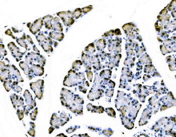 Anti-Elongin-C/ELOC Antibody
