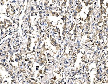 Anti-Elongin-C/ELOC Antibody