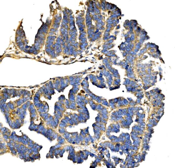 Anti-Elongin-C/ELOC Antibody