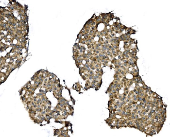 Anti-Elongin-C/ELOC Antibody