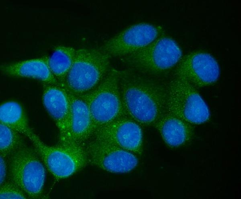 Anti-TCEB2/Elongin-B/ELOB Antibody