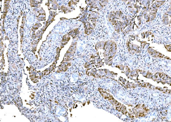 Anti-DPY19L1 Antibody