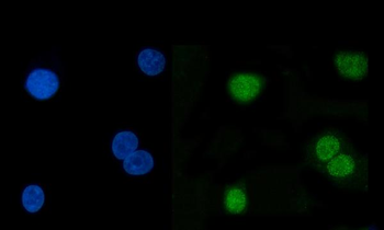 Anti-Hsp40/DNAJB1 Antibody