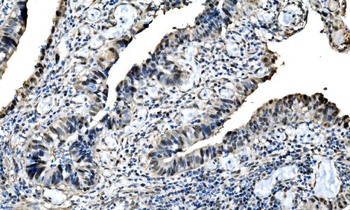 Anti-DLX2 Antibody