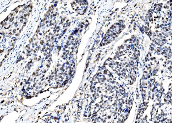 Anti-DLX2 Antibody