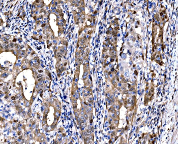 Anti-DLX2 Antibody