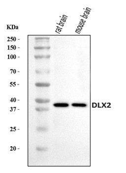 Anti-DLX2 Antibody